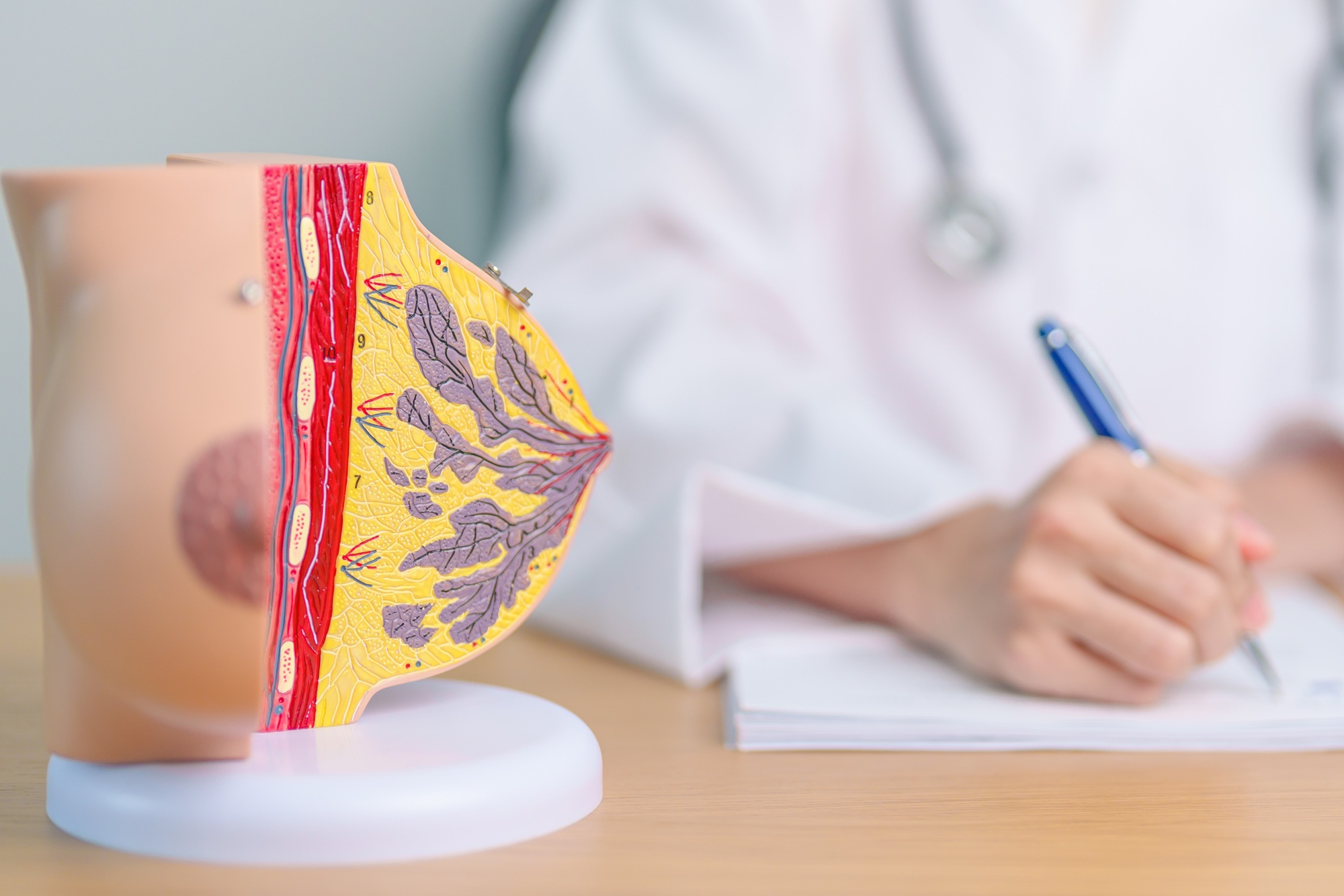 breast cancer health professional taking notes